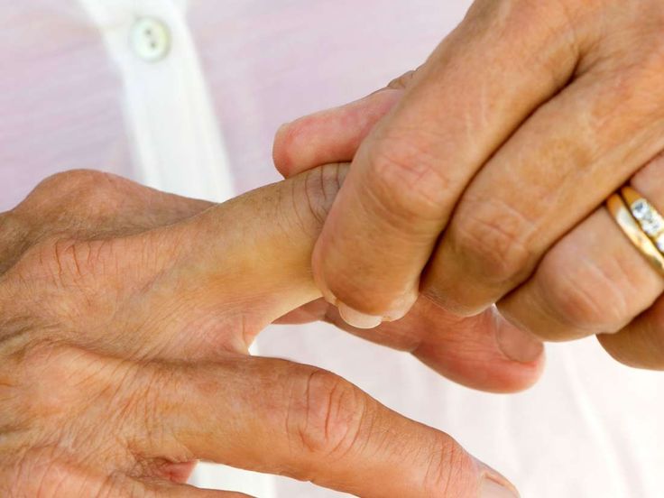 Causes and treatments for twitching fingers