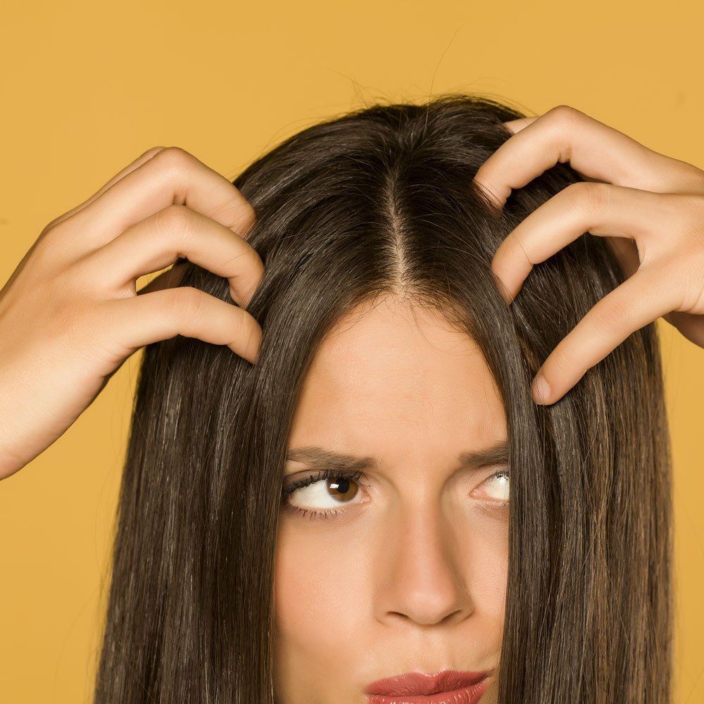 Dandruff: What are the causes? Is it contagious?