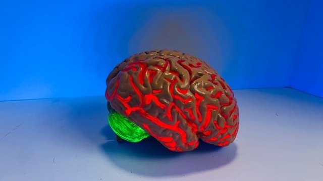 Deep Brain Stimulation Remains Effective for Parkinson