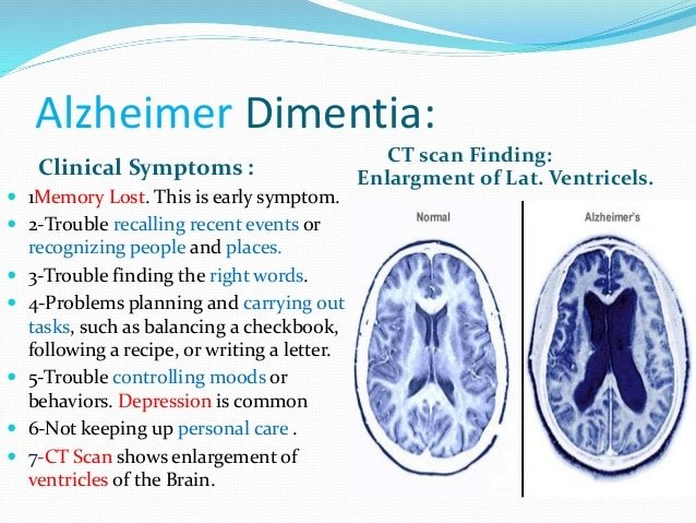 Dementia Power. Point