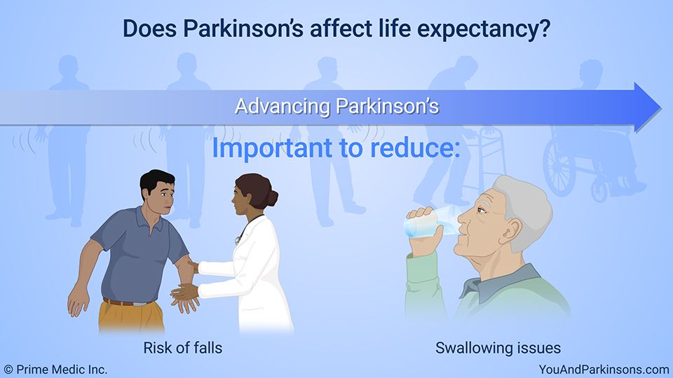 Does Parkinsonâs affect life expectancy? After learning ...