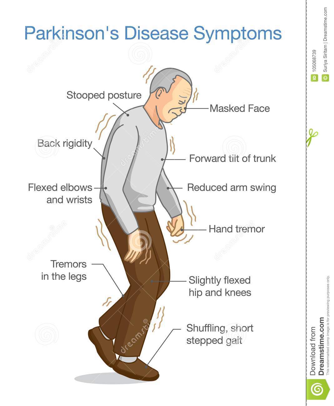 Illustration about Parkinson`s Disease Symptoms. Stock Vector ...