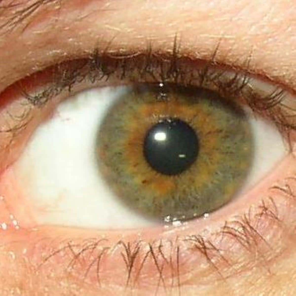 Ocular tremors common in Parkinson