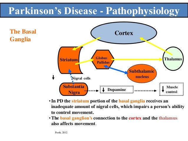 parkinson disease pathophysiology diagram