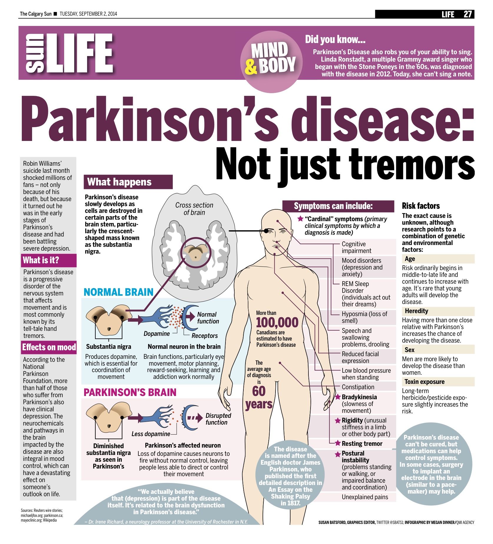 parkinson disease stages
