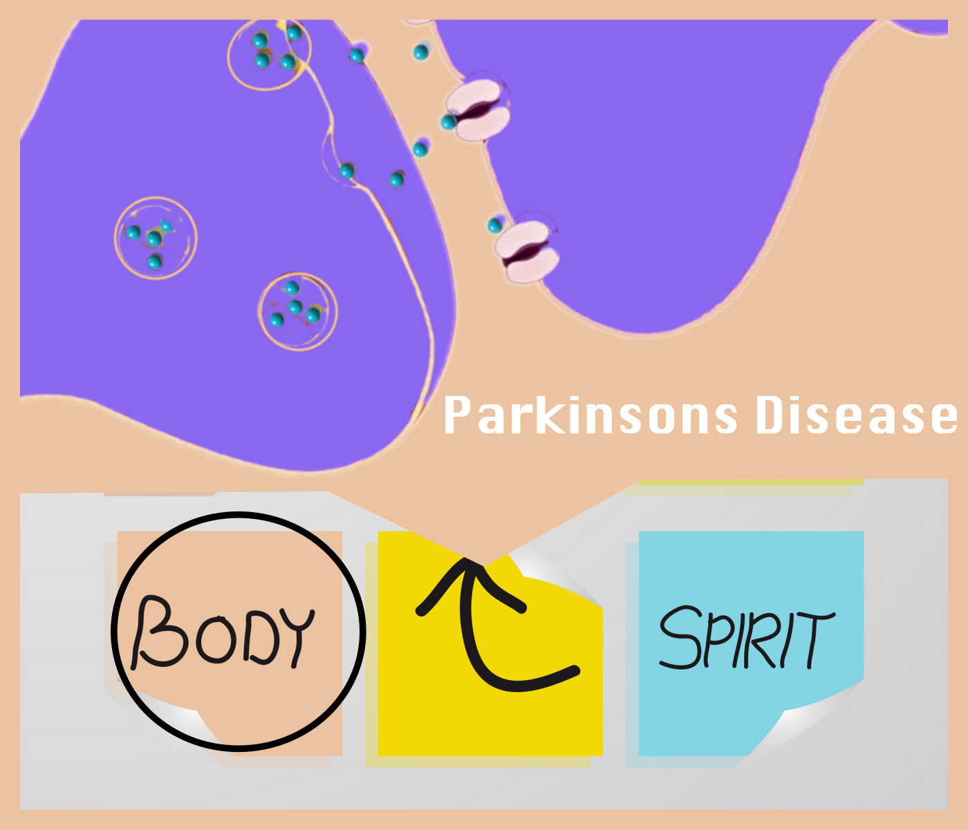Parkinson Disease: What Causes Back Pain?