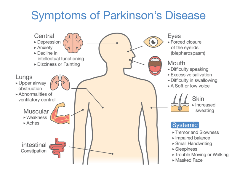 Parkinsonâs Disease: Signs, Risks and Treatme