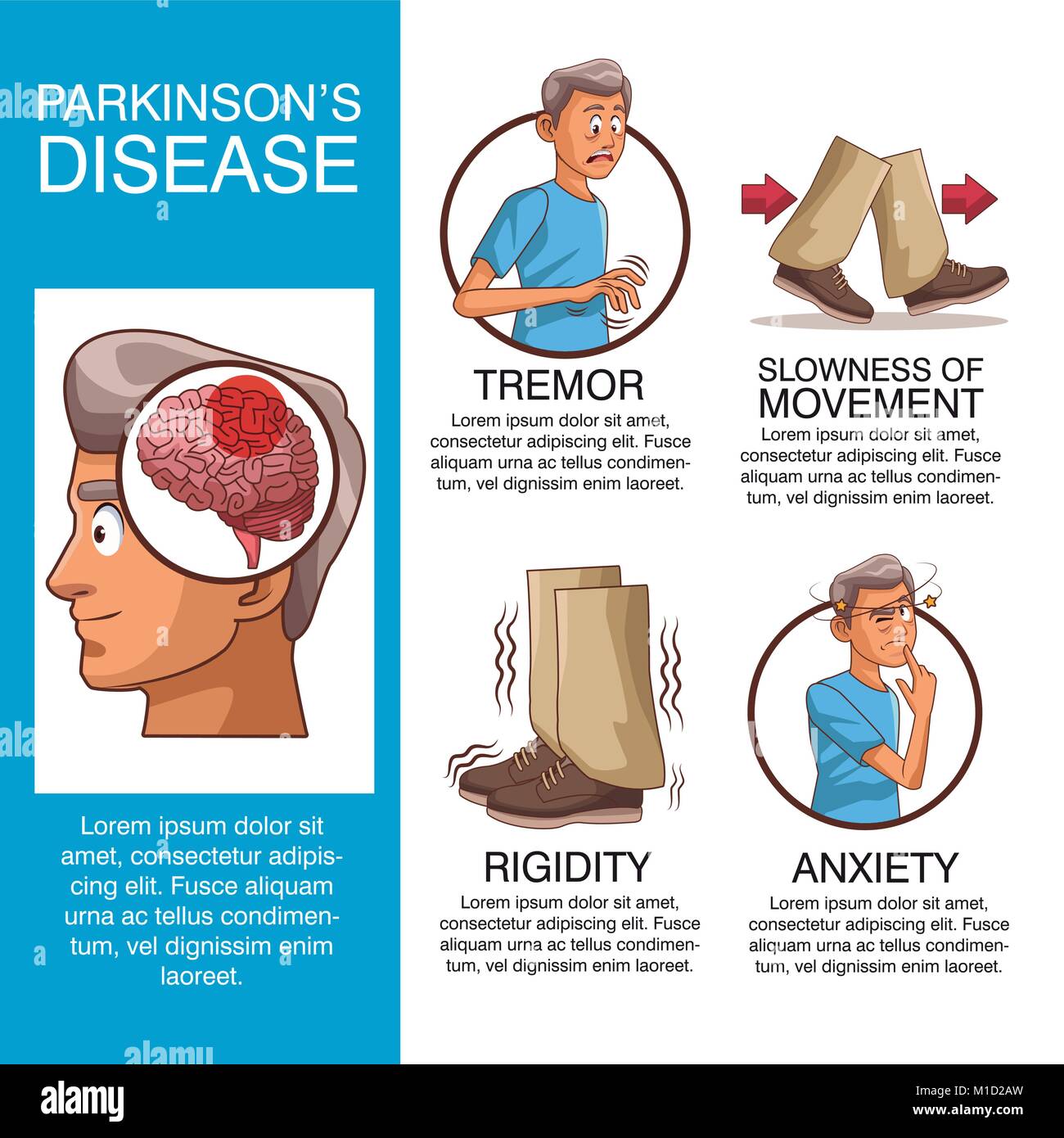 Parkinsons disease infographic Stock Vector Image &  Art
