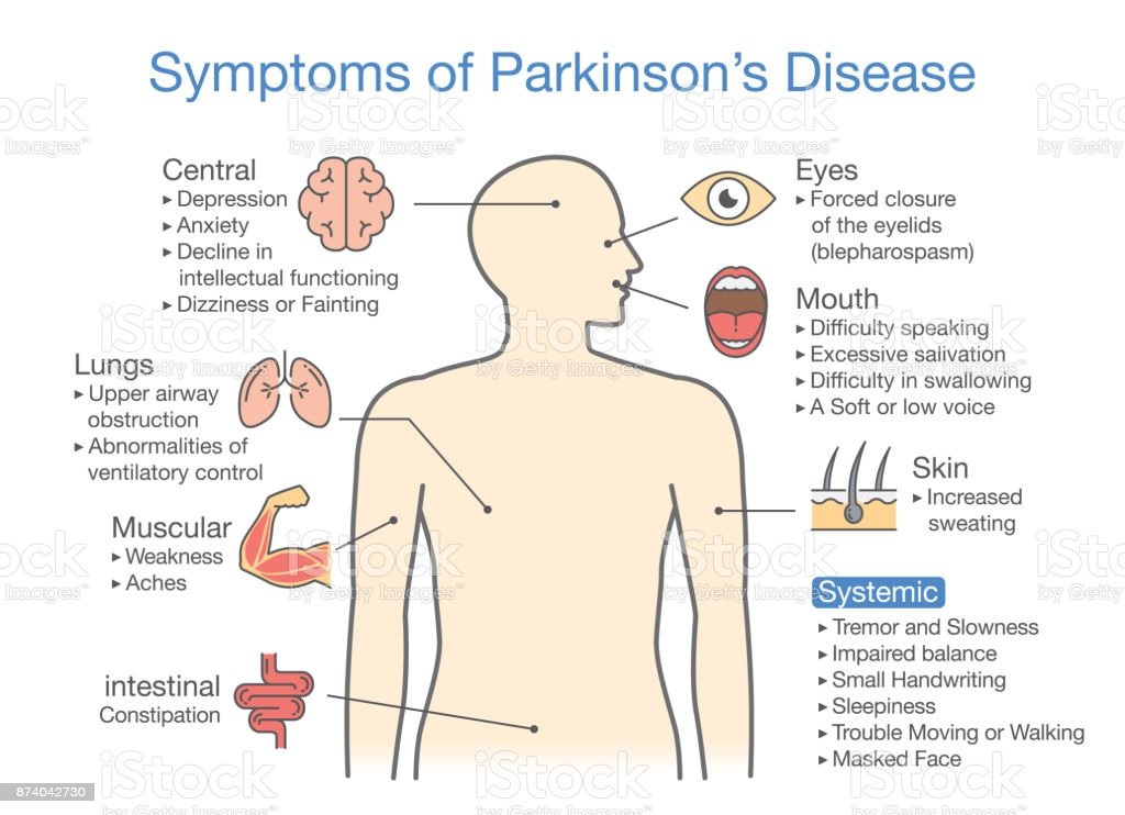 Parkinsons Disease Symptoms And Signs Stock Illustration ...