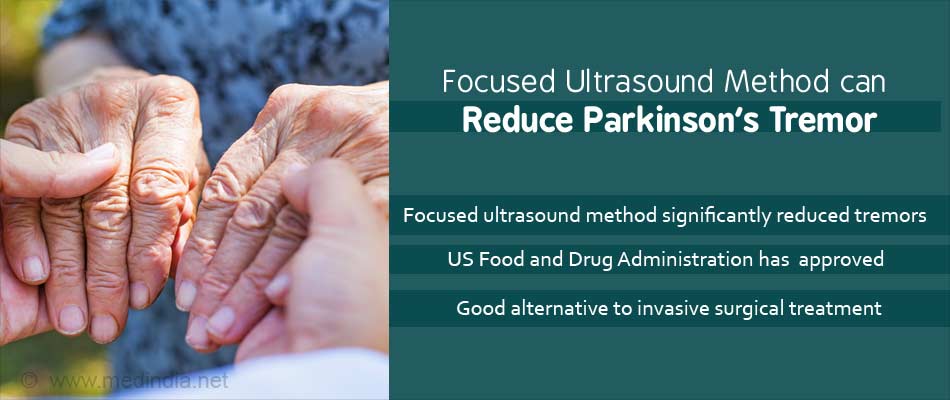 Parkinsons Tremors can now be Reduced by the Focused ...