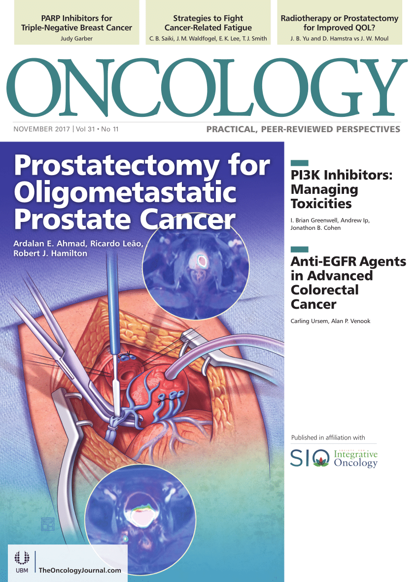 (PDF) Radical Prostatectomy for Patients With ...