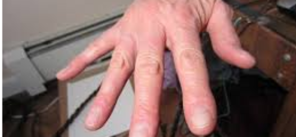 Shaky hand and tremors causes and solutions  Why are my ...