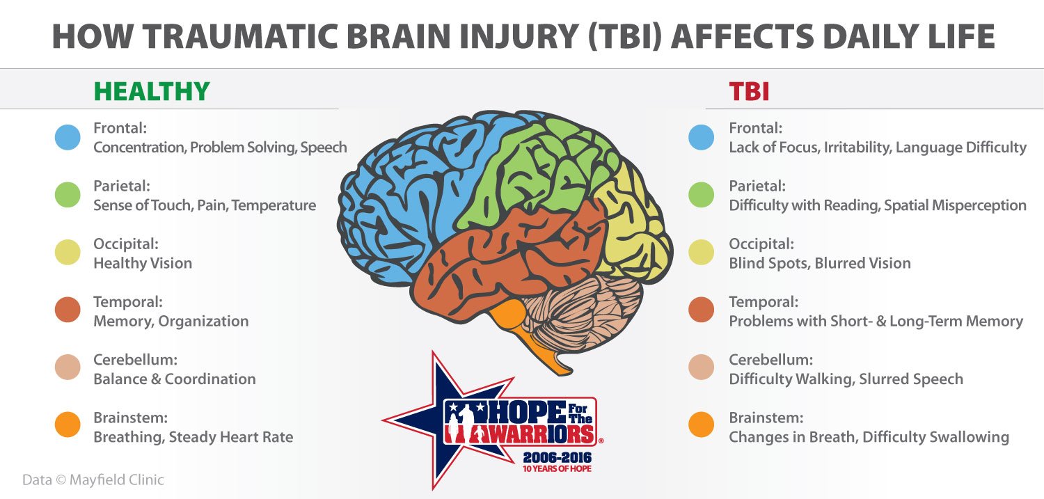 The Truth About Traumatic Brain Injuries