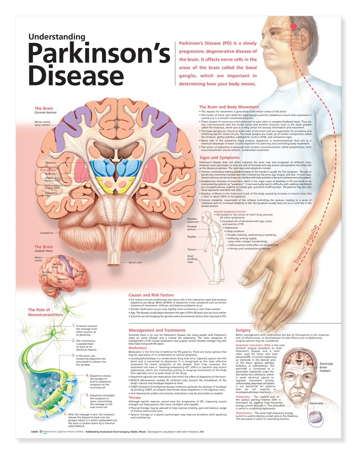 Understanding Parkinsonâ€™s Disease Anatomical Chart, 2nd ...