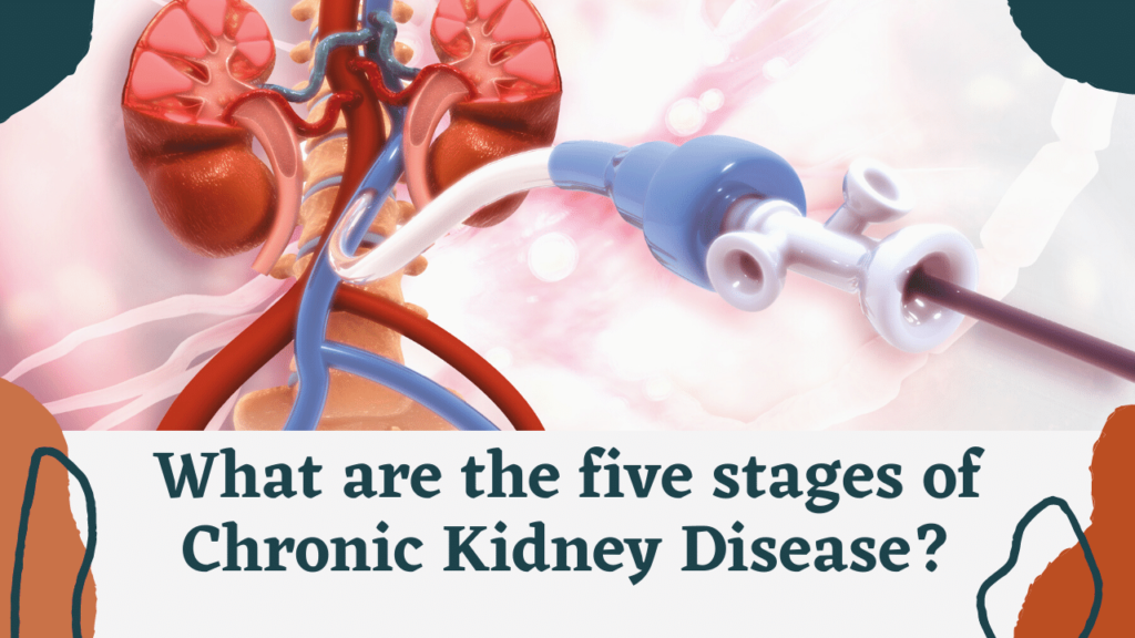 What are the five stages of Chronic Kidney Disease?