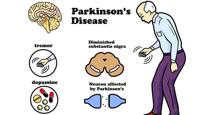 What Causes Parkinson